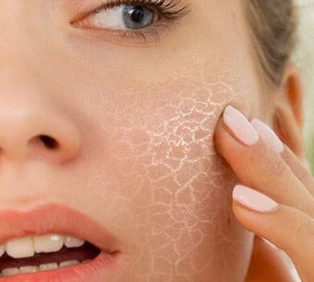 Hydra Fluid by Piel – Piel by Miguelina